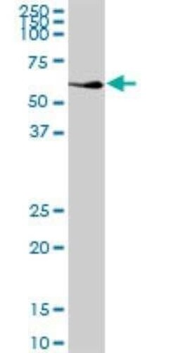 NDP52 Antibody, Novus Biologicals 0.05 mg | Buy Online | Novus Biologicals | Fisher Scientific