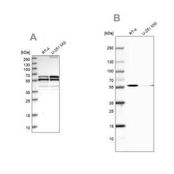NDP52 Antibody, Novus Biologicals 25 &mu;L; Unconjugated:Antibodies, Polyclonal