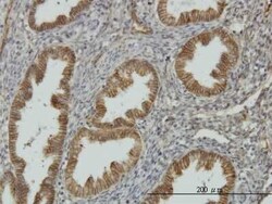 NDRG1 Antibody (2D7), Novus Biologicals 0.1 mg | Buy Online | Novus Biologicals | Fisher Scientific