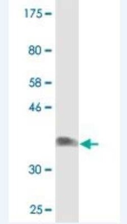 NDST3 Antibody (3A9), Novus Biologicals 0.1 mg | Buy Online | Novus Biologicals | Fisher Scientific