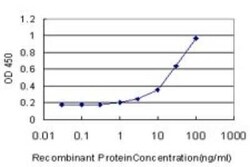 NDST3 Antibody (5B9), Novus Biologicals 0.1 mg | Buy Online | Novus Biologicals | Fisher Scientific