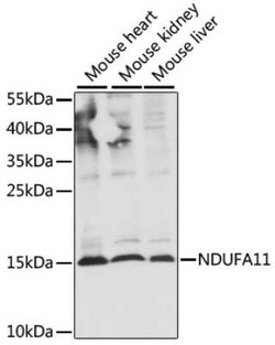 NDUFA11 Antibody - Azide and BSA Free, Novus Biologicals 0.02 mL; Unconjugated:Antibodies,