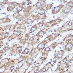 NDUFA4 Antibody - Azide and BSA Free, Novus Biologicals:Antibodies:Primary