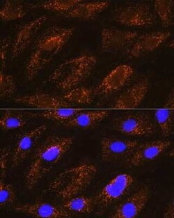 NDUFA8 Antibody - Azide and BSA Free, Novus Biologicals:Antibodies:Primary