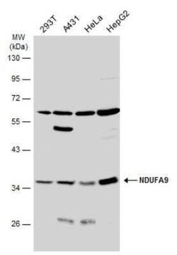 NDUFA9 Antibody, Novus Biologicals 100 &mu;g | Buy Online | Bio-Techne | Fisher Scientific