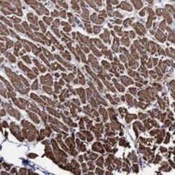 NDUFAB1 Rabbit anti-Human, Polyclonal, Novus Biologicals 25 &mu;g; Unconjugated:Antibodies,