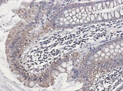 NDUFB1 Antibody (S04-4H3), Novus Biologicals 100 &mu;g | Buy Online | Novus Biologicals | Fisher Scientific