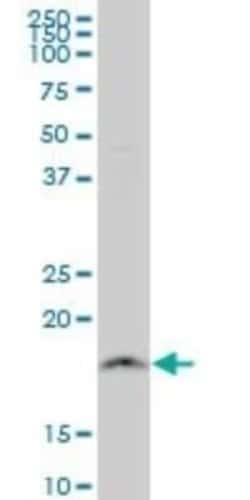 NDUFB11 Antibody (4B2), Novus Biologicals 0.1 mg | Buy Online | Novus Biologicals | Fisher Scientific
