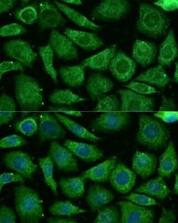 NDUFB3 Antibody - Azide and BSA Free, Novus Biologicals 0.1 mL, Unconjugated:Antibodies,