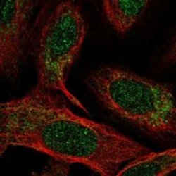 NDUFB4 Rabbit anti-Human, Polyclonal, Novus Biologicals 100 &mu;g; Unconjugated:Antibodies,