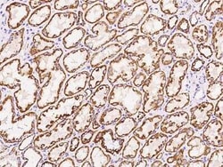 NDUFB5 Antibody, Novus Biologicals:Antibodies:Primary Antibodies