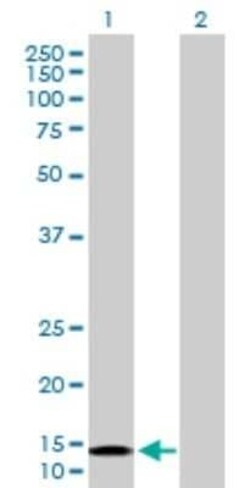 NDUFB6 Antibody, Novus Biologicals 0.1 mg | Buy Online | Novus Biologicals | Fisher Scientific