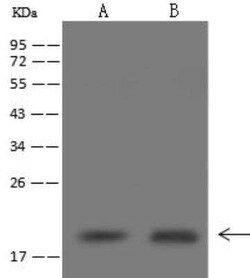 NDUFB6 Antibody, Novus Biologicals 100 &mu;g; Unconjugated:Antibodies,