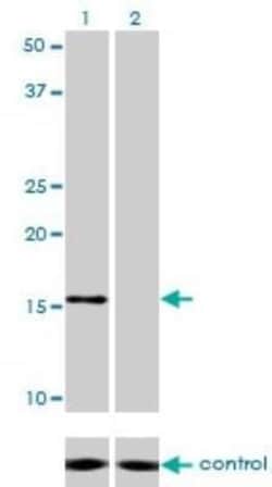 NDUFB7 Antibody (4D4), Novus Biologicals 0.1 mg | Buy Online | Novus Biologicals | Fisher Scientific