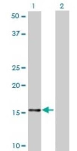 NDUFB7 Antibody (4D4), Novus Biologicals 0.1 mg | Buy Online | Novus Biologicals | Fisher Scientific