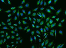 NDUFB8 Antibody, Novus Biologicals:Antibodies:Primary Antibodies