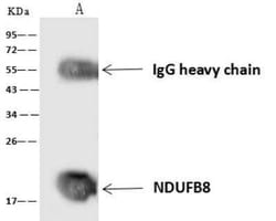 NDUFB8 Antibody, Novus Biologicals:Antibodies:Primary Antibodies