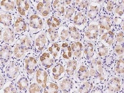 NDUFB9 Antibody, Novus Biologicals:Antibodies:Primary Antibodies