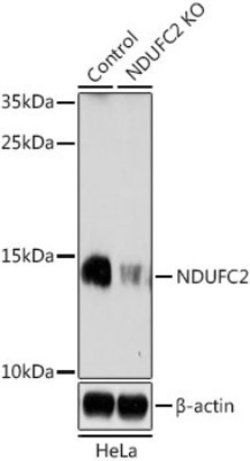 Glucuronosyltransferase 1A1/UGT1A1 Rabbit anti-Human, Mouse, Rat, Polyclonal,