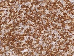 NDUFS3 Antibody, Novus Biologicals 50 &mu;g, Unconjugated:Antibodies, Polyclonal