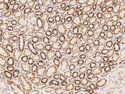 NDUFS5 Antibody, Novus Biologicals 50 &mu;g; Unconjugated:Antibodies, Polyclonal