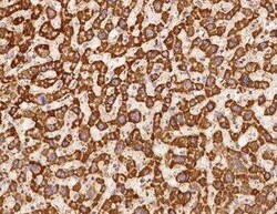 NDUFS5 Antibody, Novus Biologicals 50 &mu;g; Unconjugated:Antibodies, Polyclonal