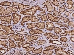 NDUFS6 Antibody, Novus Biologicals 50 &mu;g; Unconjugated:Antibodies, Polyclonal