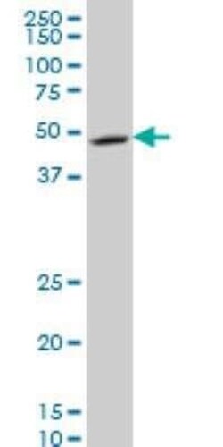NDUFV1 Antibody (4A7), Novus Biologicals 0.1 mg | Buy Online | Novus Biologicals | Fisher Scientific