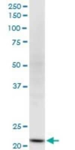 NDUFV2 Antibody (1A10), Novus Biologicals 0.1 mg | Buy Online | Novus Biologicals | Fisher Scientific