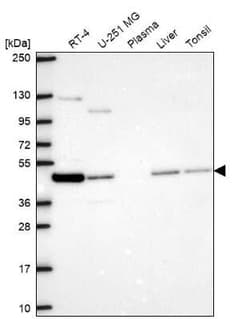 NECAB3 Antibody, Novus Biologicals 100 &mu;g; Unconjugated:Antibodies,