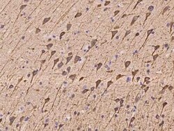 NECAP2 Antibody, Novus Biologicals 100 &mu;g | Buy Online | Novus Biologicals | Fisher Scientific