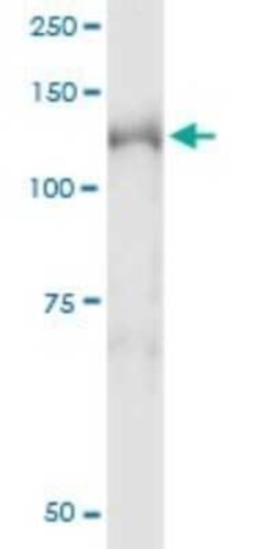 NEDD4L Antibody (1D2), Novus Biologicals 0.1 mg | Buy Online | Novus Biologicals | Fisher Scientific