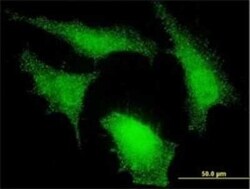 NEDD9/CASL/HEF1 Antibody (1B4), Novus Biologicals 100 &mu;g | Buy Online | Novus Biologicals | Fisher Scientific