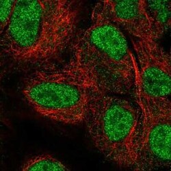 NEIL2 Antibody, Novus Biologicals 100 &mu;g; Unconjugated:Antibodies, Polyclonal