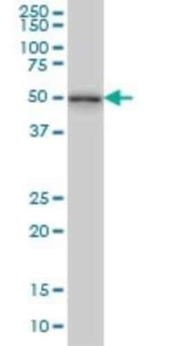 NEK2 Antibody (3B7), Novus Biologicals 0.1 mg | Buy Online | Novus Biologicals | Fisher Scientific