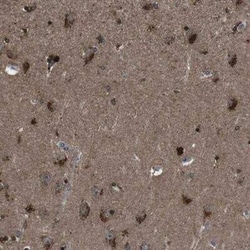 NEK7 Antibody, Novus Biologicals 25 &mu;L | Buy Online | Novus Biologicals | Fisher Scientific