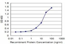 NELL1 Antibody (3F1), Novus Biologicals 0.1 mg, Unconjugated:Antibodies,