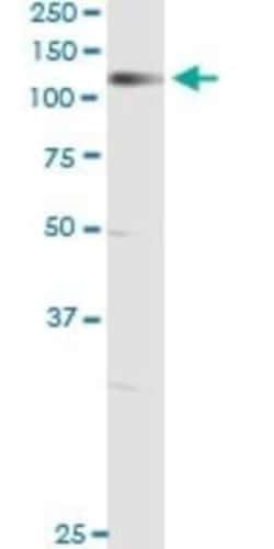 NELL1 Antibody (6A8), Novus Biologicals 0.1 mg | Buy Online | Novus Biologicals | Fisher Scientific