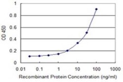 NELL2 Antibody (1F6), Novus Biologicals 0.1 mg | Buy Online | Novus Biologicals | Fisher Scientific