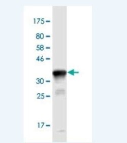 NEU-1/Sialidase-1 Antibody (3F9), Novus Biologicals 100 &mu;g | Buy Online | Novus Biologicals | Fisher Scientific