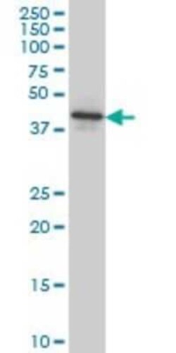 Novus Biologicals NEU2 Antibody (3B9), Novus Biologicals 0.1 mg | Buy Online | Novus Biologicals&trade; | Fisher Scientific
