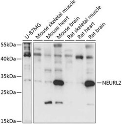 NEURL2 Antibody - Azide and BSA Free, Novus Biologicals 0.02 mL; Unconjugated:Antibodies,