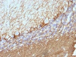 NF-H Antibody (NE14), Novus Biologicals:Antibodies:Primary Antibodies