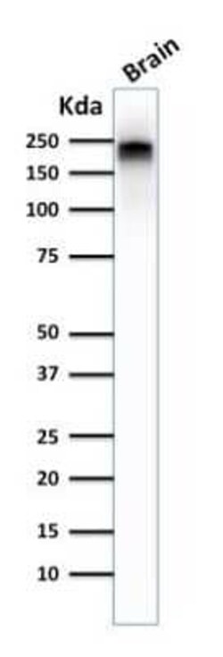 NF-H Antibody (NE14), Novus Biologicals:Antibodies:Primary Antibodies