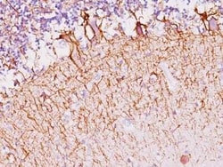 NF-H Antibody (SPM145), Novus Biologicals:Antibodies:Primary Antibodies