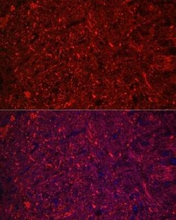 NF-L Rabbit anti-Human, Mouse, Rat, Clone: 3L9Y10, Novus Biologicals 20