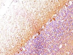 NF-L Antibody (SPM204), Novus Biologicals:Antibodies:Primary Antibodies
