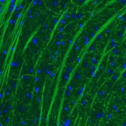 NF-M Antibody (CL2688), Novus Biologicals 0.1 mL, Unconjugated:Antibodies,