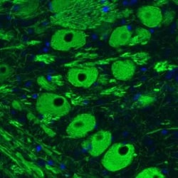 NF-M Antibody (CL2705), Novus Biologicals:Antibodies:Primary Antibodies