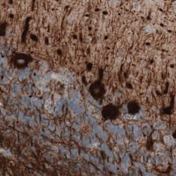 NF-M Antibody (CL2705), Novus Biologicals:Antibodies:Primary Antibodies